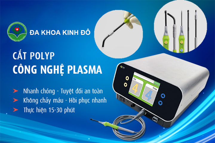 Cắt polyp bằng dao plasma tại đa khoa Kinh Đô Bắc Giang