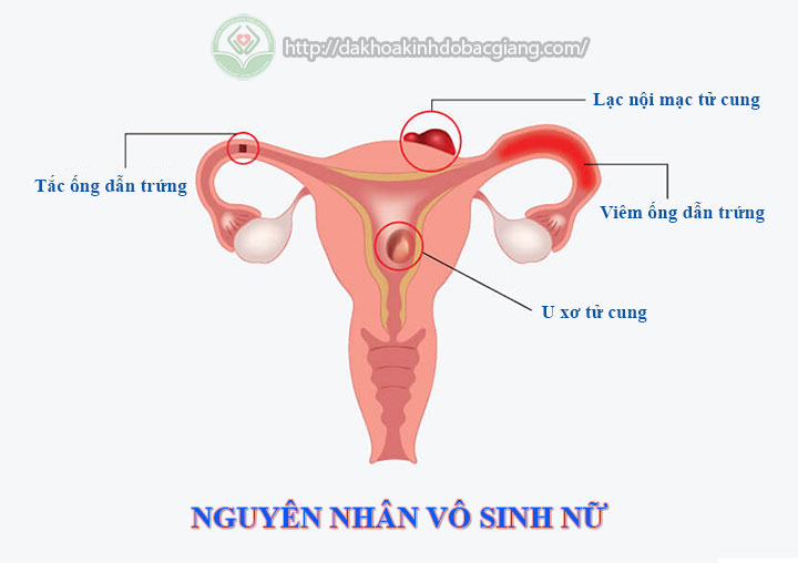 nguyen-nhan-vo-sinh-nu