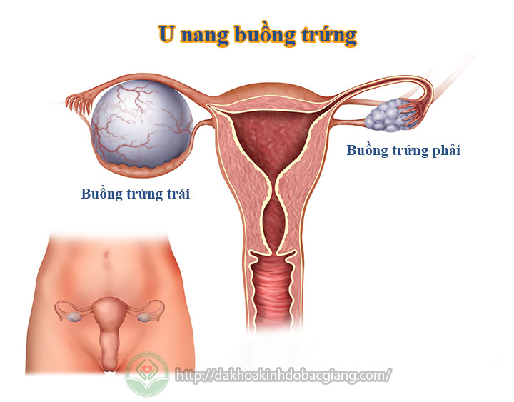 u-nang-buong-trung
