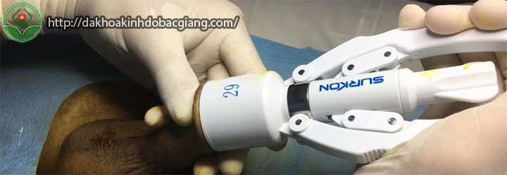 cat-bao-quy-dau-bang-may-Stapler-Surkon