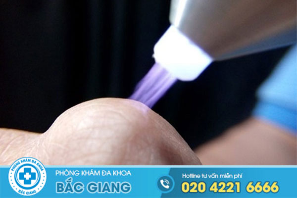 phuong-phap-dieu-tri-sui-mao-ga-tot-nhat