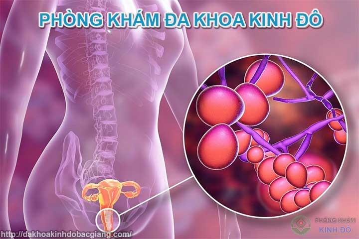 Nấm phụ khoa