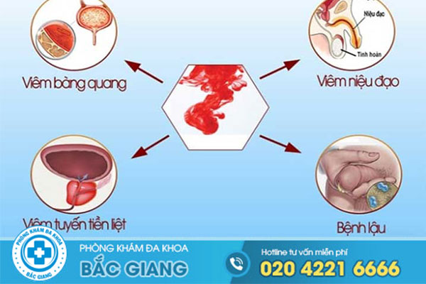 di-tieu-ra-mau-la-benh-gi