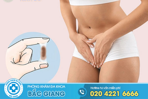 dia-chi-kham-phu-khoa-o-bac-giang-tot-nhat