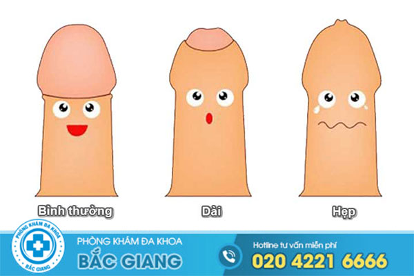 chia-se-chi-phi-phau-thuat-cat-bao-quy-dau