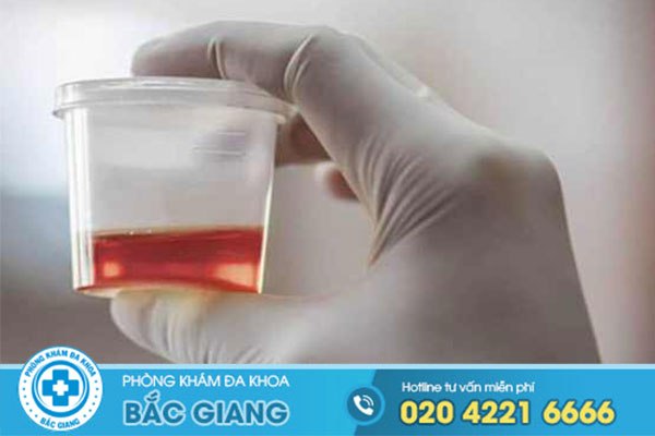 di-tieu-ra-mau-la-benh-gi